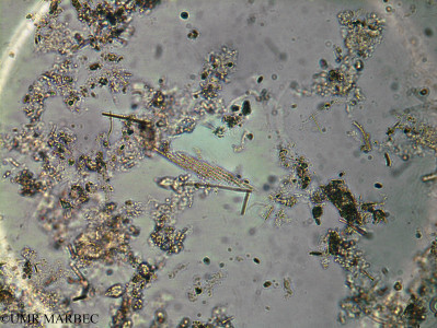 phyto/Brazilian_Amazon_coast/Amazomix_station_33/AMAZOMIX September 2021/Bacillaria paxillifera (Am_ST33_fond_tabellaria240829_003)(copy)_thumb.jpg